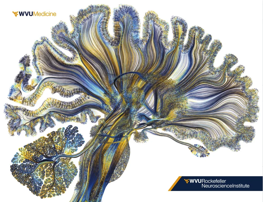 WVU Medicine's Rockefeller Neuroscience Institute brochure cover